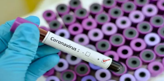 Covid-19 : Un 49e Etat africain affecté par le coronavirus